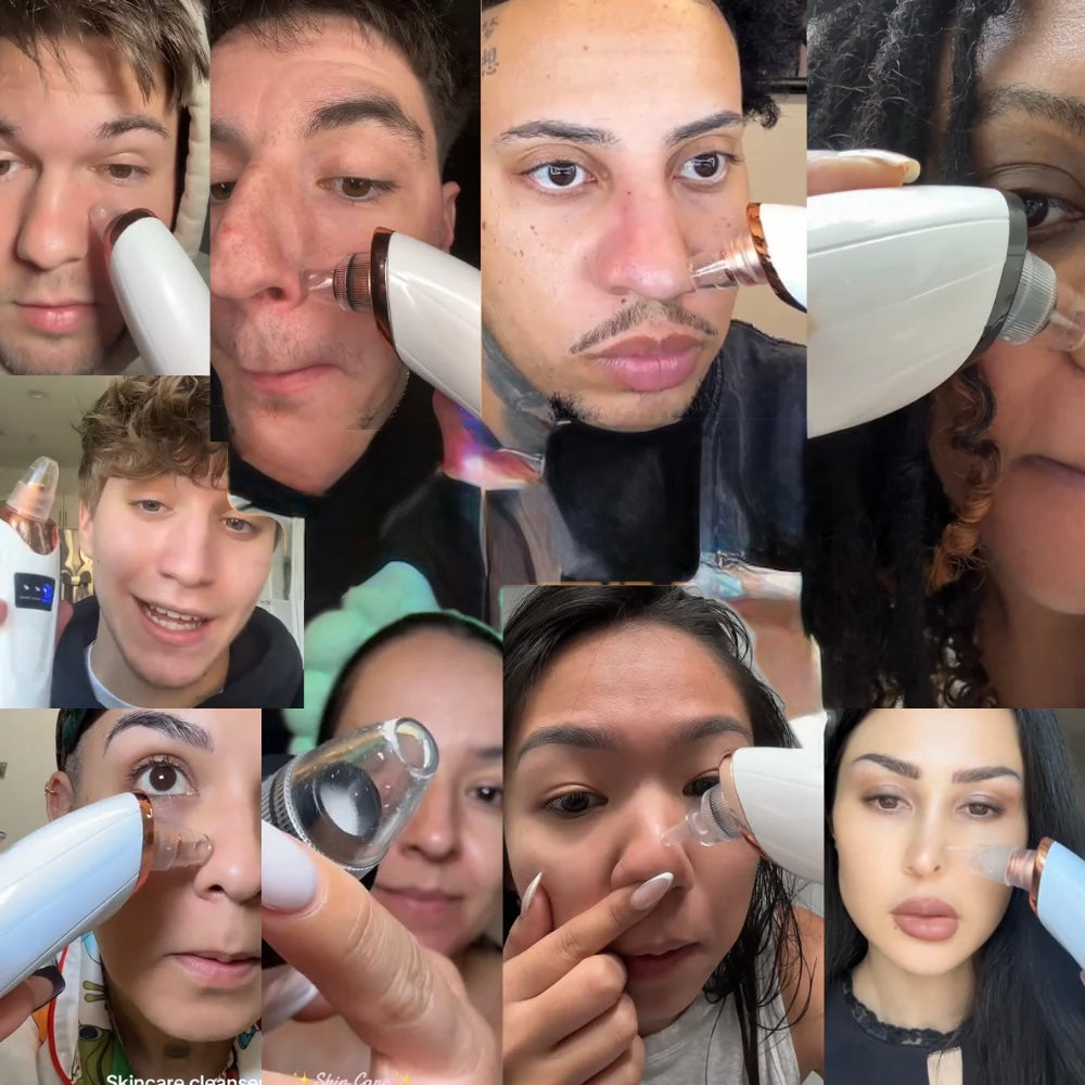 Nour Facial Pore Vacuum